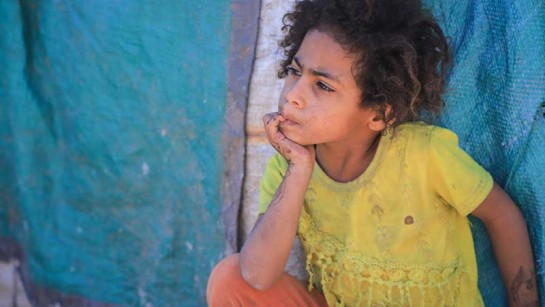 Barnen i Jemen kämpar för att överleva.